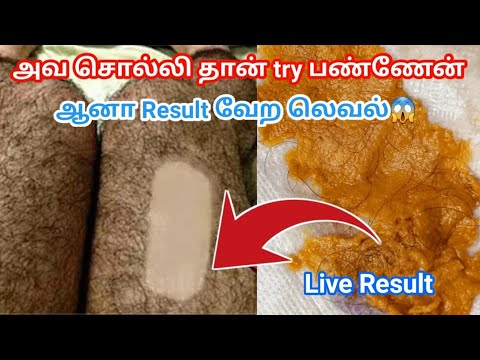 பெண்கள் இதை தடவினால் முகத்தில் முடி சுத்தமாக வளராது / Permanent Facial Hair Removal / 100% Natural 💚