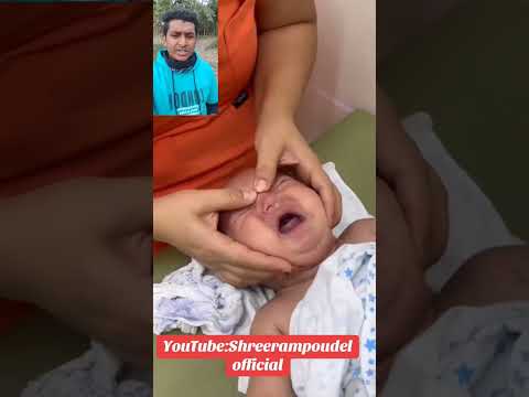 আপনার সন্তানের সর্দি থাকলে এই ট্রেডমেন্ট টি করতে পারেন #baby  #babyshorts #shorts #trending #sad