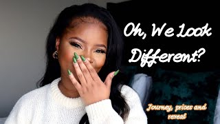 Got A Bag And Fixed My Teeth? Life Changing Experience #thepinktable