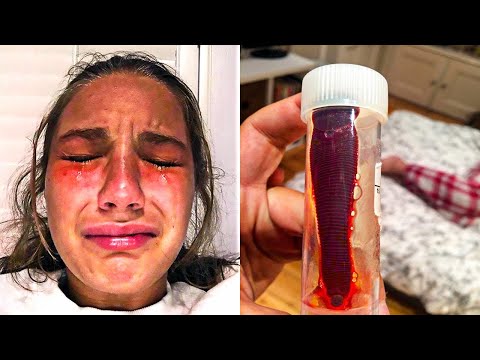 this was inside her nose..