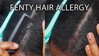 Fenty Hair Wrecked My Scalp | ASMR Scalp Scratching Storytime