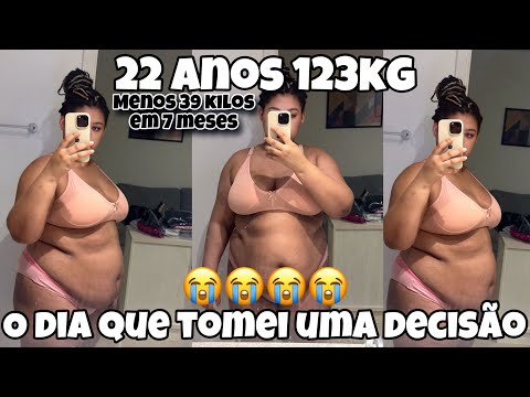 O DIA DA MINHA CIRURGIA BARIÁTRICA - ELIMINEI 39 KILOS EM 7 MESES 😭🙏🏼