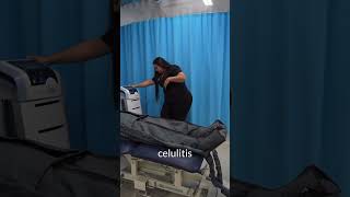 ¿Piernas cansadas o pesadas? 🦵 La presoterapia es un gran alivio, pero ¡ojo con los mitos! 🚫 NO el