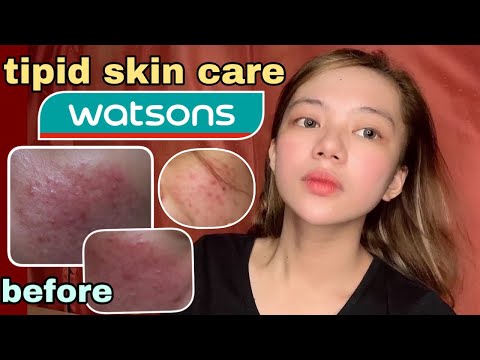 SKIN CARE ROUTINE (LAHAT SA WATSONS MABIBILI) | PAANO NAWALA ANG PIMPLES KO?