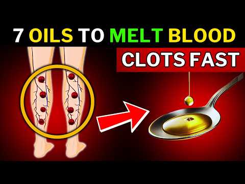 7 Oils That Melt Blood Clots Like Ice