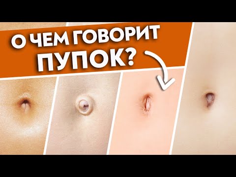 Диагностика органов по пупку | Пупок скажет ВСЁ о вашем здоровье! Постановка пупка на место