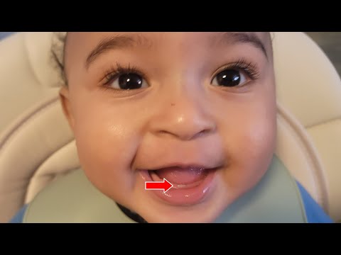 My Baby FIRST Teeth Coming? Get Ready for the Cuteness Overload!