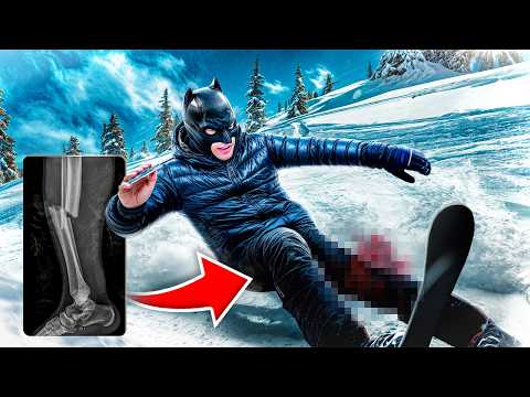 Je me détruit le genou au SKI (habillé en Batman)