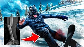 Je me détruit le genou au SKI (habillé en Batman)