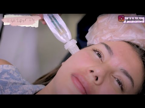 PERAWATAN ACNE SCARS || BANOBAGI KLINIK / BEAUTIQUE KOREA