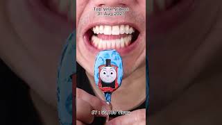 The Most Satisfying Chocolate and Candy ASMR Compilation 🍫🍬 #DoctorTristanPeh