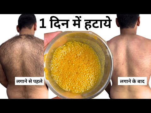 बिना Wax- बिना Pain, 1 दिन में हटायें अनचाहे बाल अपनी Body से| Remove Unwanted Hair at Home easily|