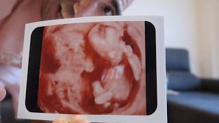 SOMOS PAPÁS DE UNA NIÑA 👧 4 Meses de Embarazo