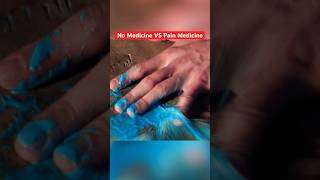 Paintballs To The Fingers… Before vs After Pain Meds #shorts #funny #entertainment