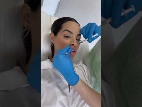 o dia que eu removi TODO o meu preenchimento labial 😅