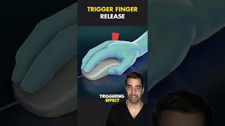 Trigger Finger