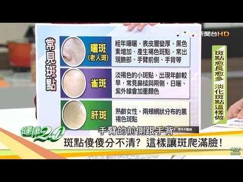 老人斑、雀斑？傻傻分不清？這樣讓斑爬滿臉 健康2.0 20161105 (1/4)