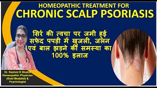 Chronic Scalp Psoriasis- Permanent Relief with homeopathy