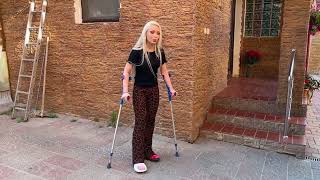 Broken leg, slc, cast, crutches