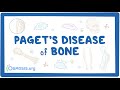 Paget's Disease: Key Concepts and Symptoms