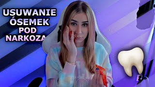 USUWANIE WSZYSTKICH ÓSEMEK POD NARKOZĄ - CZEGO SIĘ SPODZIEWAĆ?