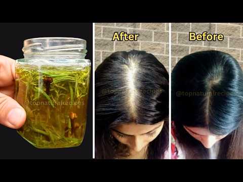 How to Make Clove and Rosemary Oil for Hair Growth | Powerful DIY Hair Oil Recipe