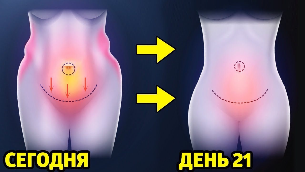 Как я сделала плоский живот и убрала бока быстрый результат