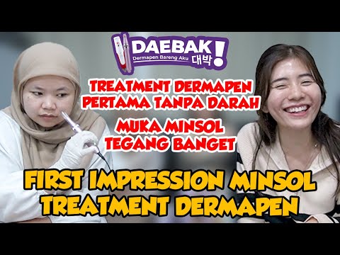 TREATMENT DERMAPEN PERTAMA TANPA DARAH 😂 - MINSOL TEGANG BANGET 😅