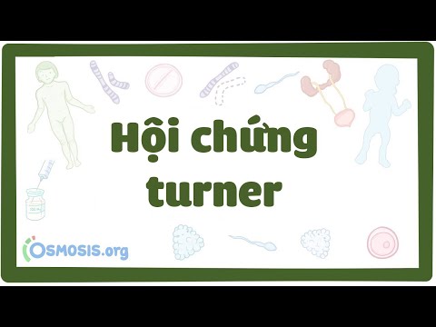 Hội chứng turner