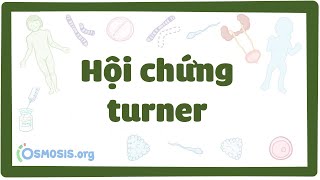 Hội chứng turner