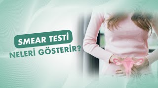 Smear Testi Nasıl Yapılır? Smear Testi Neleri Gösterir?