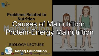Problems Related to Nutrition (Malnutrition)