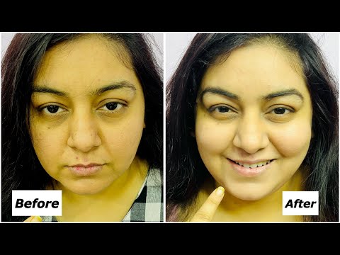 Dark Spot, Dark Circle remedy at Home | L'Oreal Paris Glycolic Bright Eye Serum | JSuper Kaur