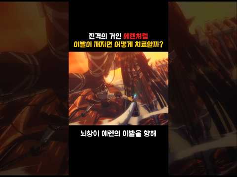 진격의 거인 에렌처럼 이빨이 깨지면 어떻게 치료할까?