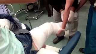Victor Turro broken Leg | BMX