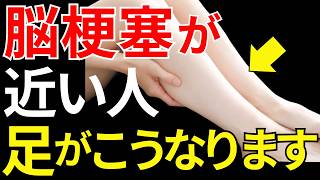 【医師監修】見逃すと危険な「脳梗塞が近い人にだけ起こる足の異変」