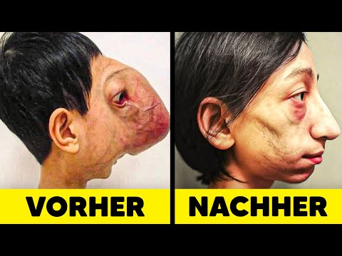 14 Kinder die VERUNSTALTET waren!