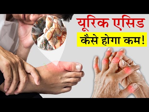 यूरिक एसिड कैसे होगा कम | How to reduce uric acid?