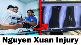 Nguyen Xuan Son Injury Update: Cidera Parah di Final AFF 2024 vs Thailand