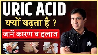 Uric Acid बढ़ने की 5 बड़ी वजह | Uric Acid को कैसे कंट्रोल करें | जानें कारण और इलाज