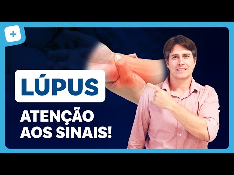 LÚPUS: o que é, sintomas e tratamento