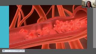 Magnetoterapia PEMF di iMRS PRIME e OMNIUM1