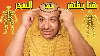 هنا يظهر تاثير السحر على الراس وكيف يتحكم السحر والجن فى راس وعقل الانسان وعلاج شيطان الراس الساحر