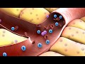 Understanding Diabetes