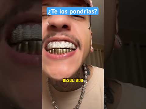 IMITANDO los dientes virales de PESO PLUMA (part.1)