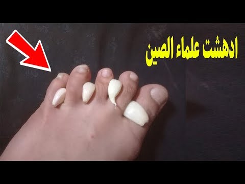 جربت تحط الثوم في قدمك قبل النوم شاهد ما يحدث افعلها قبل الندم !!!!