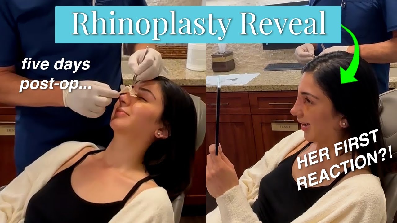 Giving her a NEW Nose! Rhinoplasty Reveal