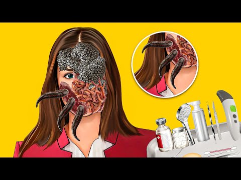 ASMR Removal Dog Ticks Worm & Maggots From Infected Face | ASMR Animation |Skincare | Animation