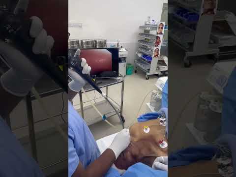 Challenging Anesthesia for less mouth opening