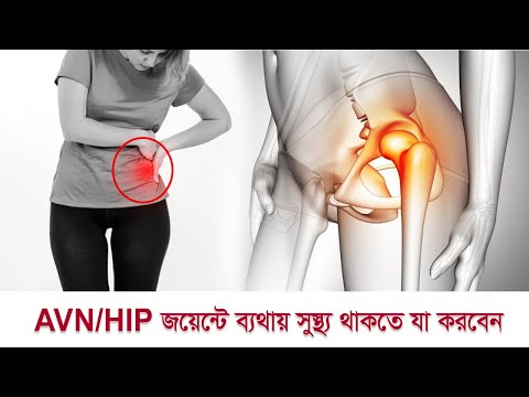 AVN/HIP জয়েন্টে ব্যথায় সুস্থ্য থাকতে যা করবেন